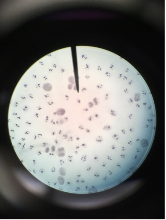 
							
								A microscope field with many cells visible. The cells have a few large speckles of stain in an unstained nucleus. 
							
							